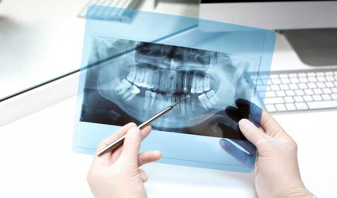 Dental Radiology